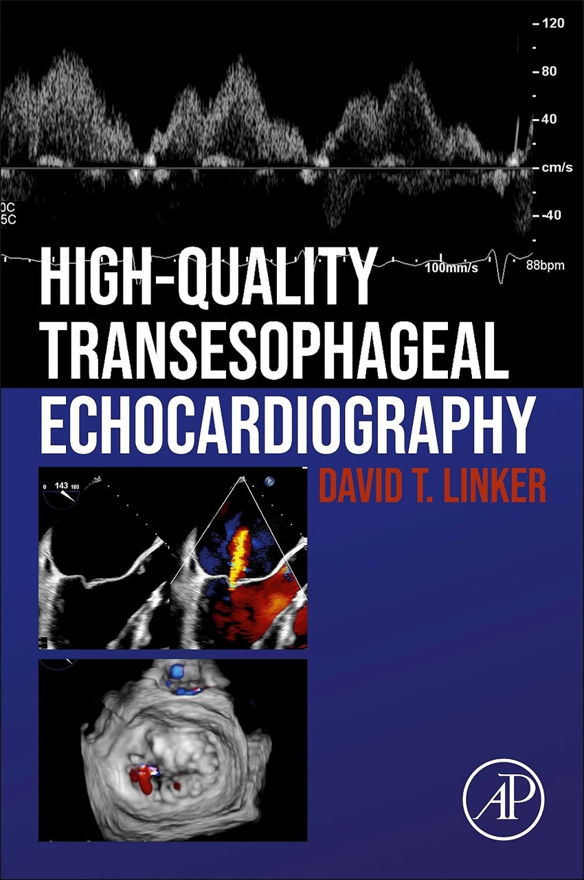 High-quality transesophageal echocardiography