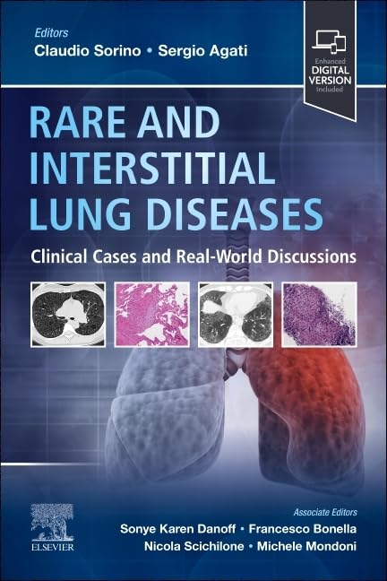  Rare and interstitial lung diseases 