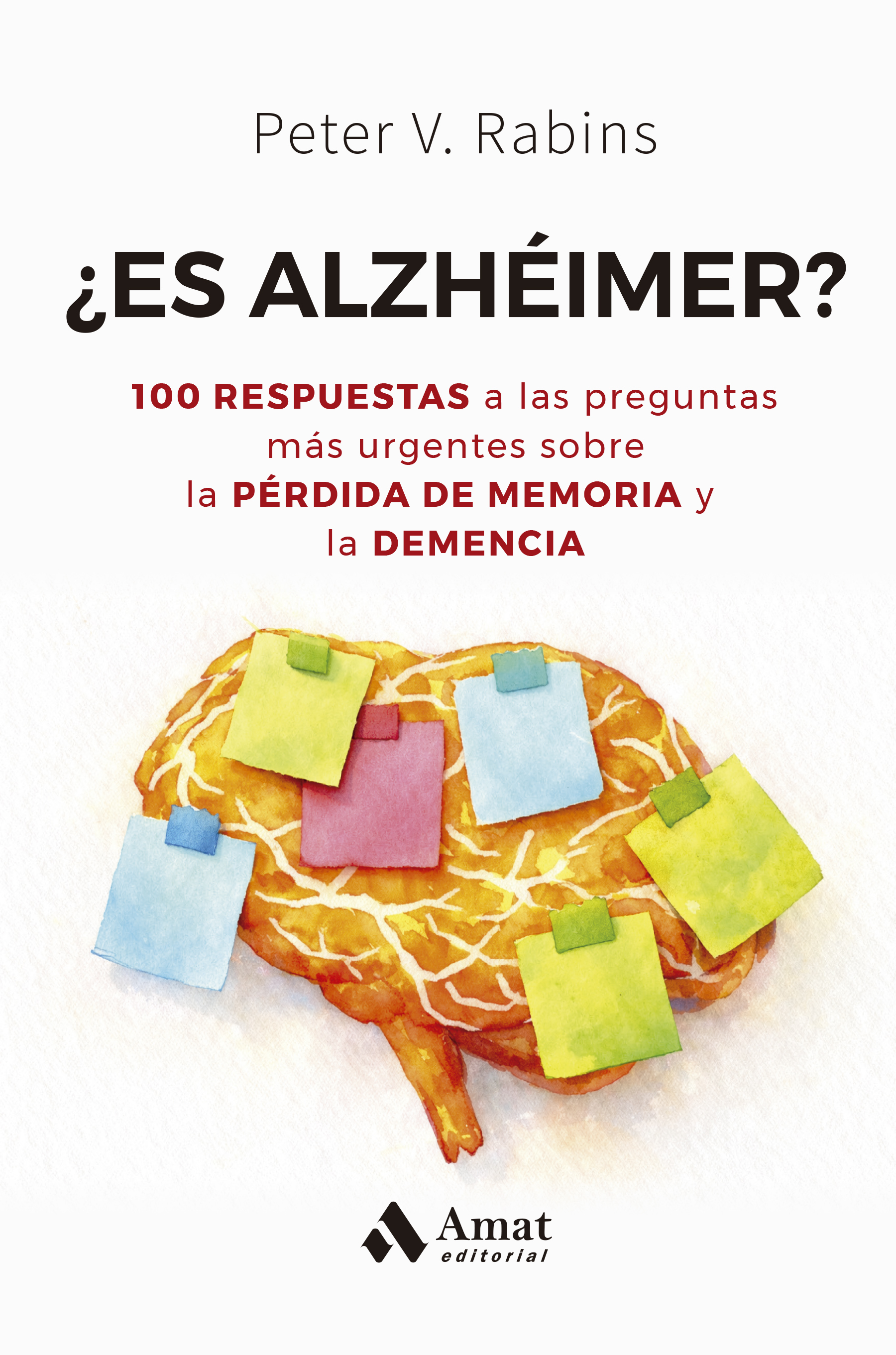  ¿Es alzheimer? 