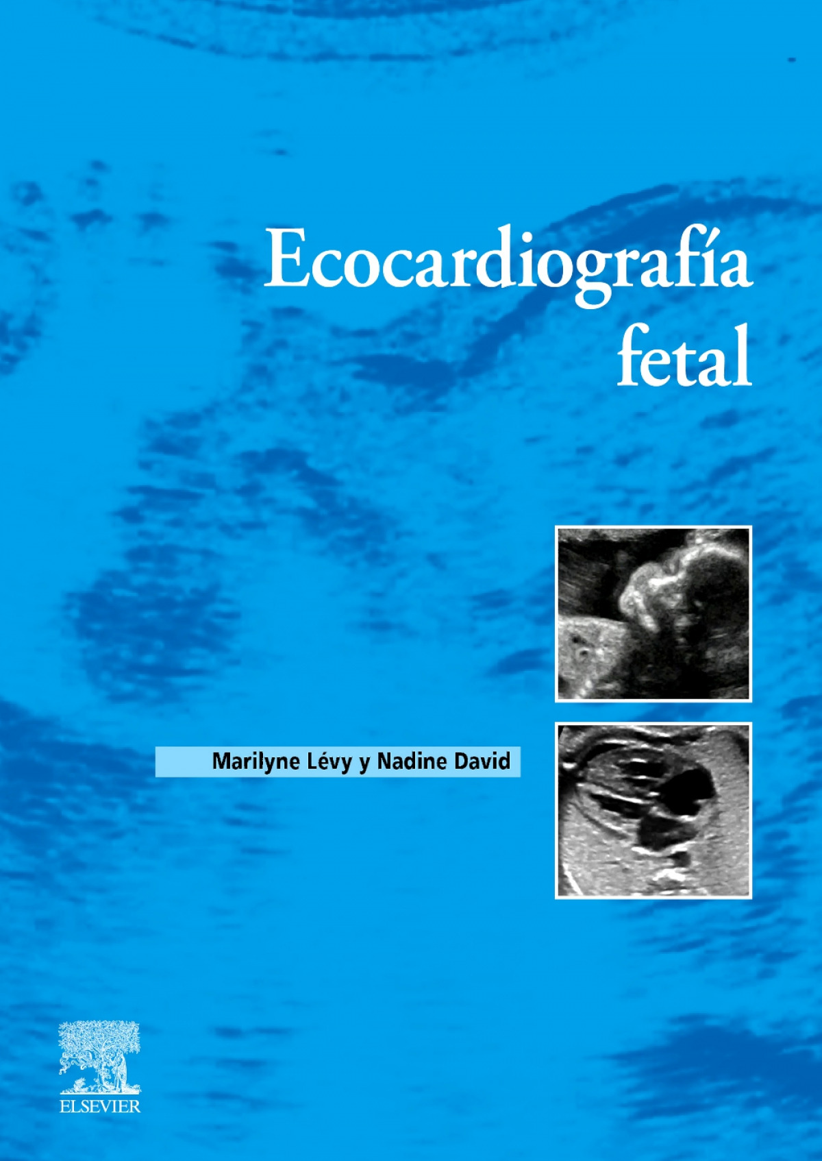 ECOCARDIOGRAFIA FETAL