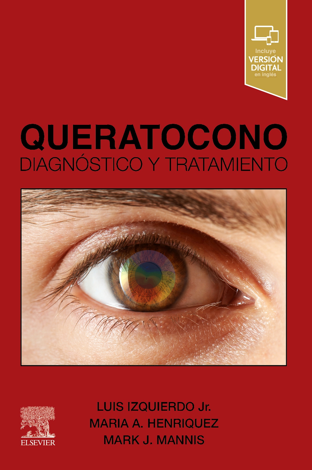  QUERATOCONO 