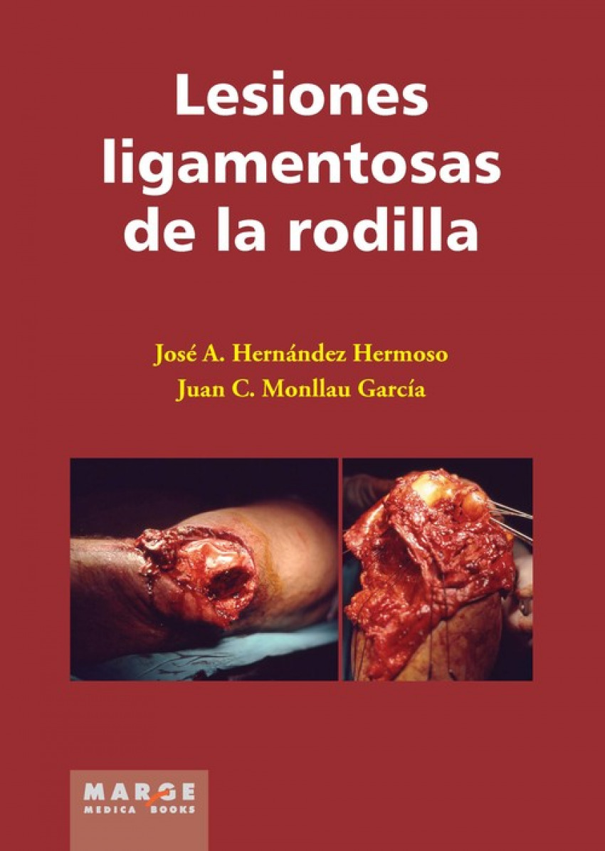 LESIONES LIGAMENTOSAS DE LA RODILLA