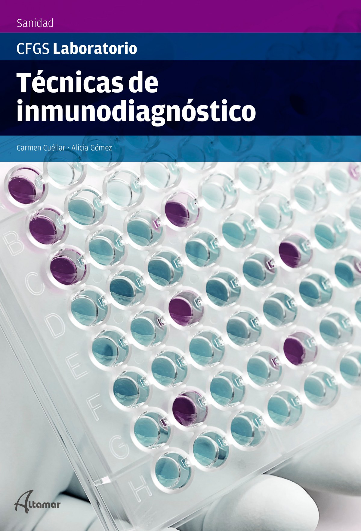  técnicas de inmunodiagnóstico 