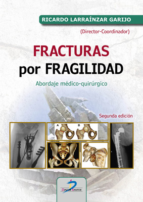 Fracturas por fragilidad