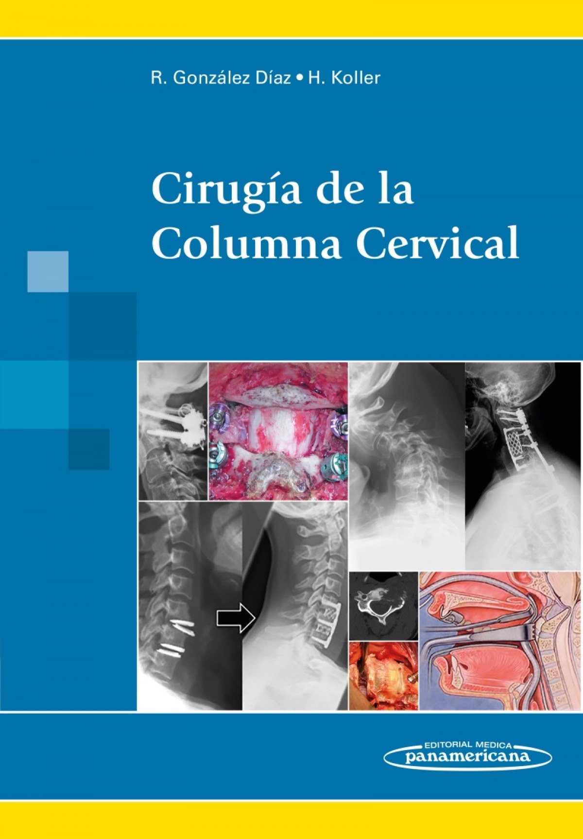 Capa