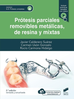 Protesis parciales removibles metalicas de resina y mixtas